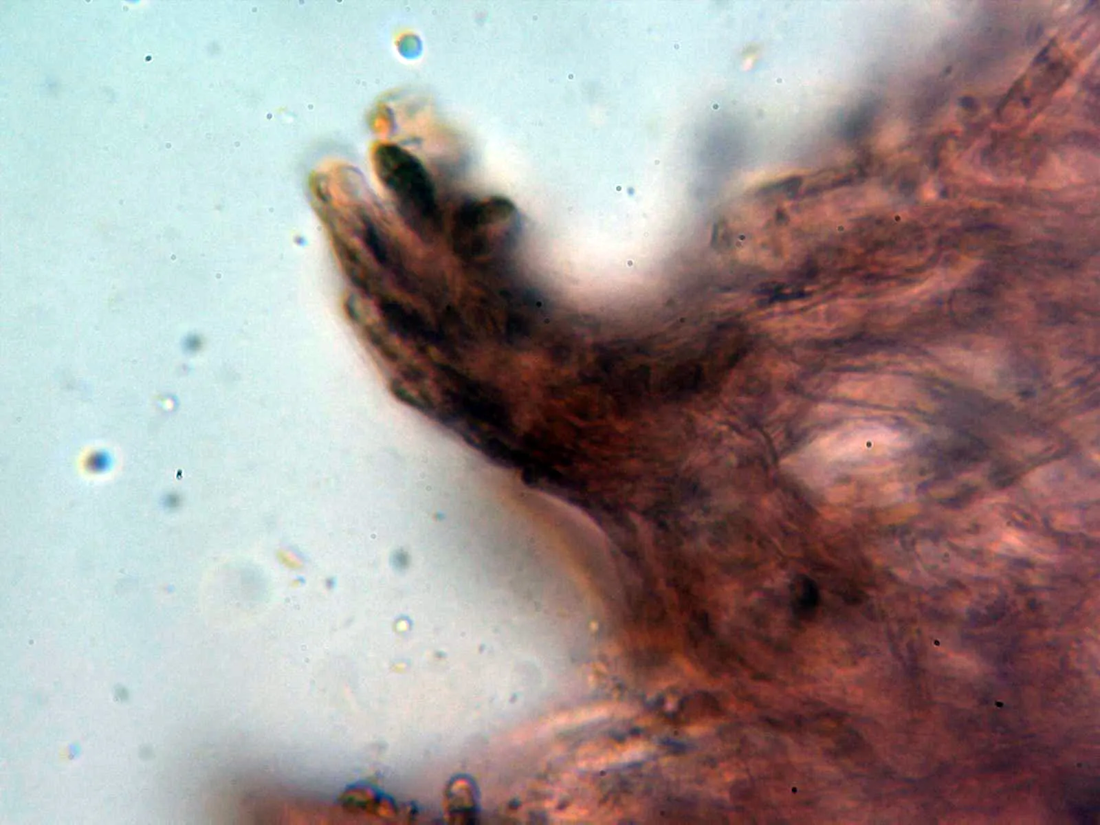 Microscopía de Pilatotrama ljubarskyi - 12 - Hifas suprapellis pigmentadas